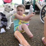Little Girl without Feet Gets Puppy Missing a Paw